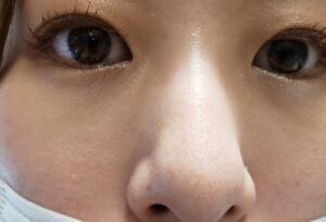 パーフェクトポアカバーを塗った肌を別の角度から見てみました②｜化粧品専門店柳屋