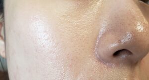 タンフリュイドエクラマットを塗る前のビフォー肌です。｜化粧品専門店柳屋